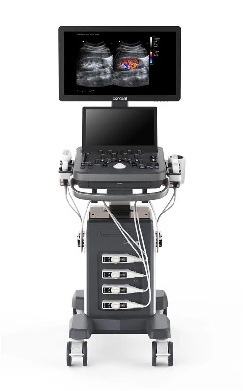 Ultrasound tal-Immaġini Doppler tal-Kulur kompatt